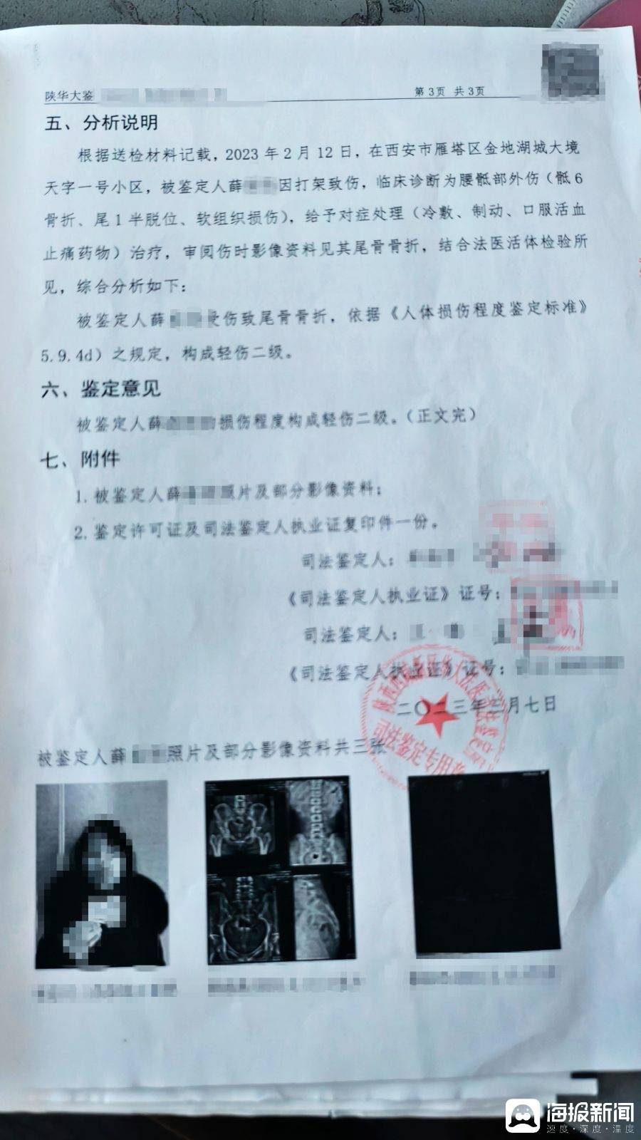 西安女子阻止邻居周末装修被打成轻伤二级 警方刑事立案后又撤案